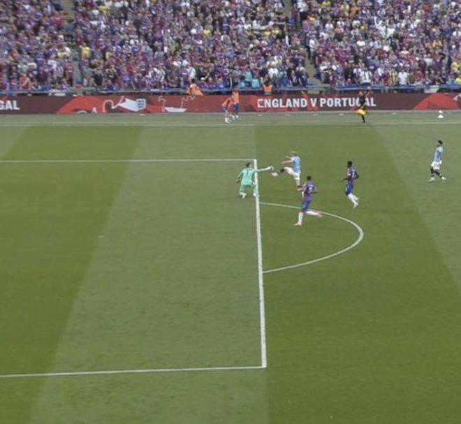 帕尔马官方：铃木彩艳左手中指及手舟骨复合骨折，将接受手术（帕尔马官宣：铃木彩艳左手中指与手舟骨复合性骨折，将接受手术治疗）